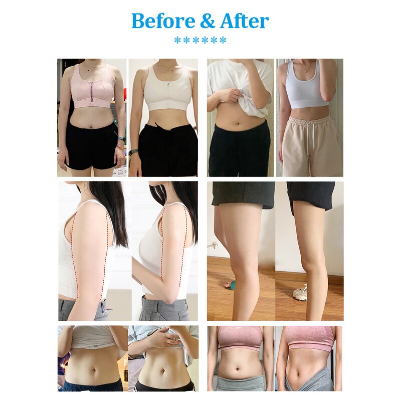 Portable Fat Freezing Machine Manufacturer - Professional 8 in 1 Plates Cryolipolysis Slimming