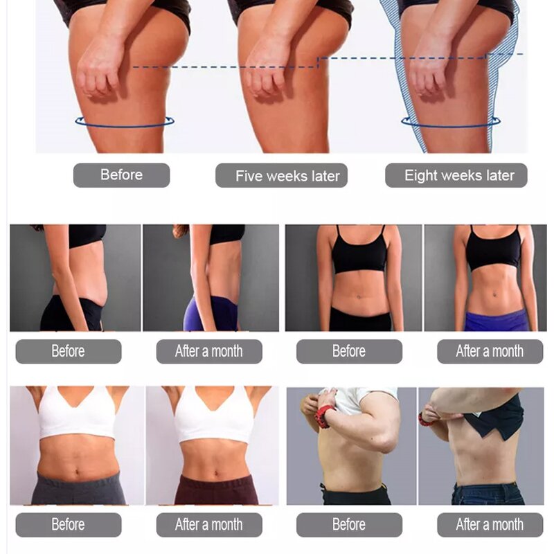 Cryotherapy Slimming Machine Manufacturer - Hot Sale Criolipolisis Fat Freezing Equipment