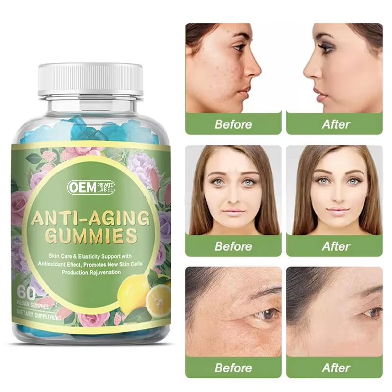 Anti-aging Gummies Factory - Skin Care Vita Healthy OEM/ODM Private Label Supply