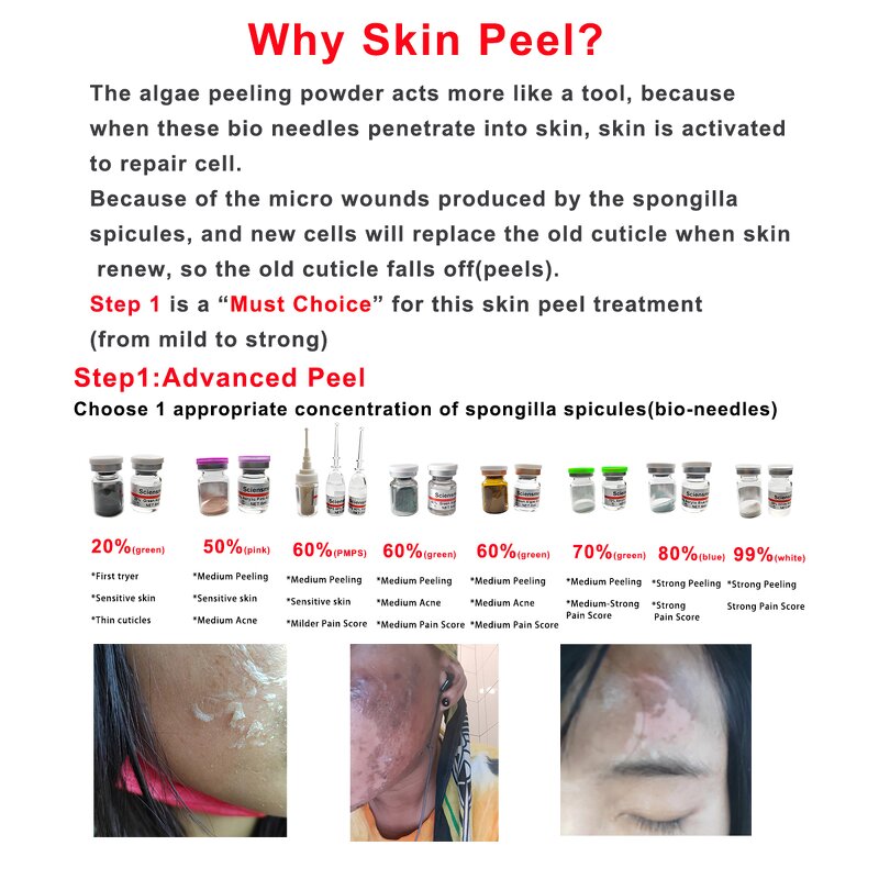 Algae Peel Manufacturer - Sciensmed 70% Advanced Skin Treatment