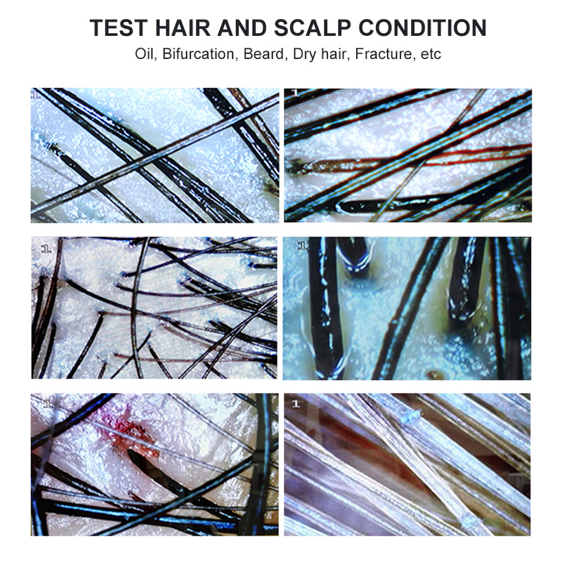 Skin Analyzer Factory - 7 Inch Scalp Detector Rechargeable