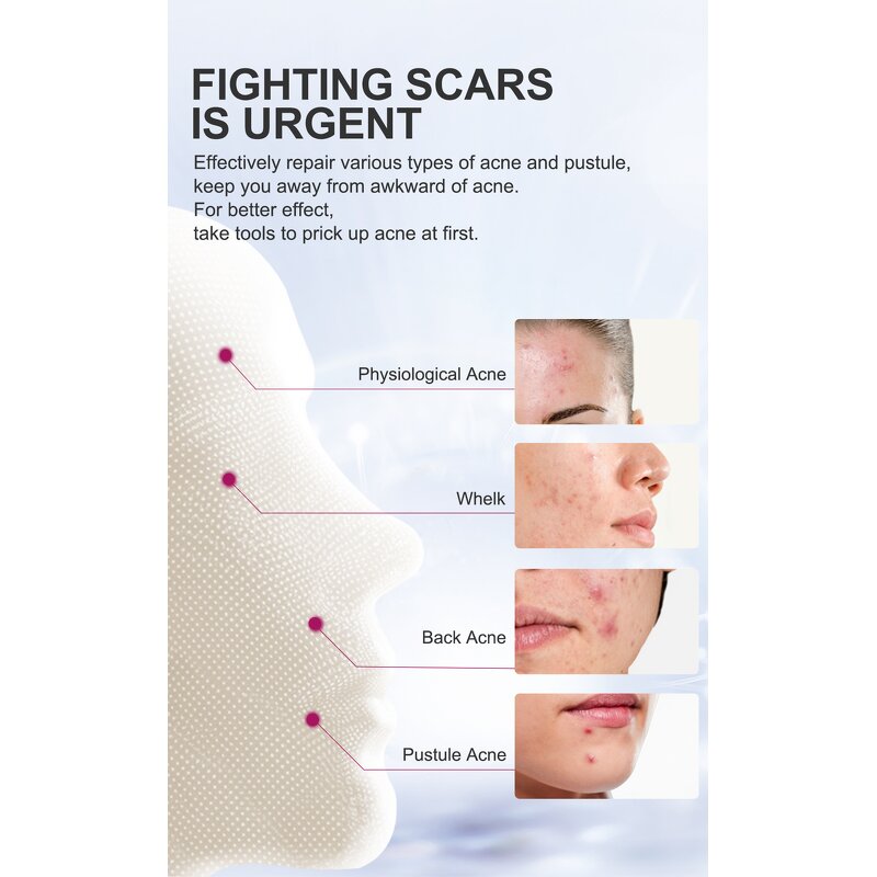 Acne Treatment Cream Manufacturer - RtopR Mango Fade Marks