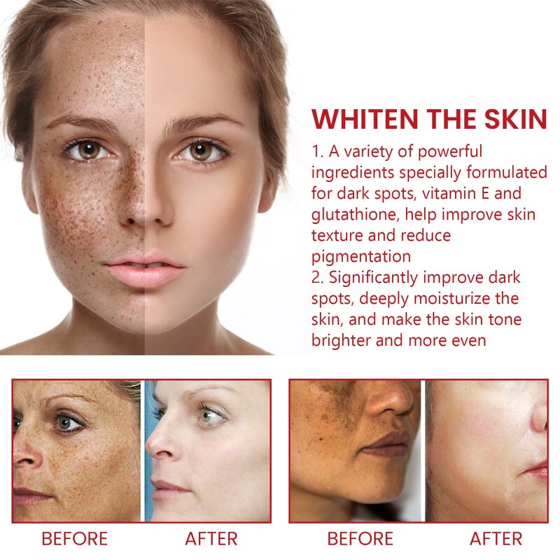 Sulfur Soap Factory - Mite Removal Liquid Fragrance