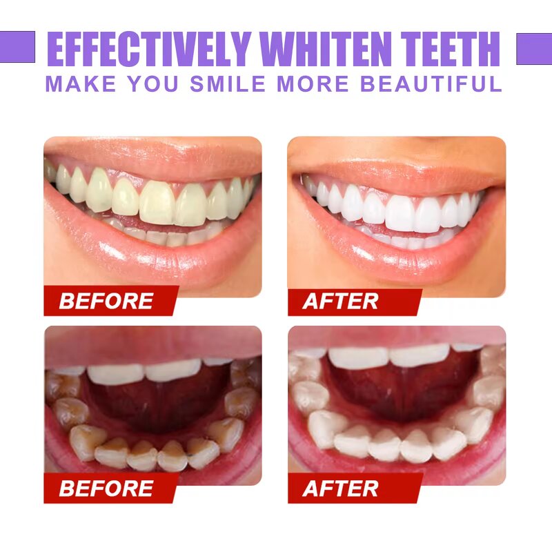 Teeth Whitening Liquid Manufacturer - Remove Yellow Stains