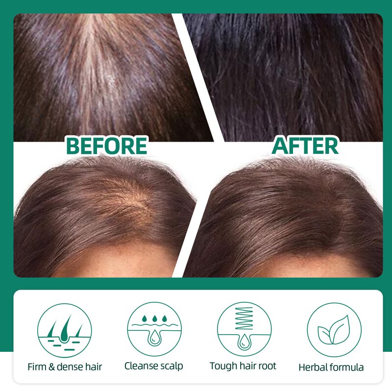 Hair Growth Lotion Manufacturer - Herbal Ginseng Ginger