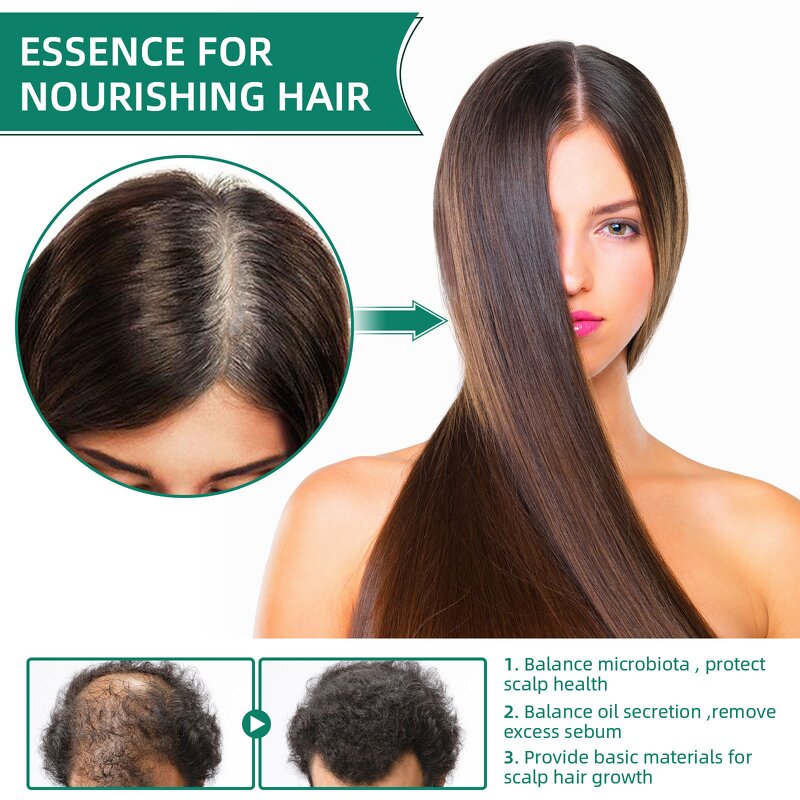 Hair Growth Lotion Manufacturer - Herbal Ginseng Ginger