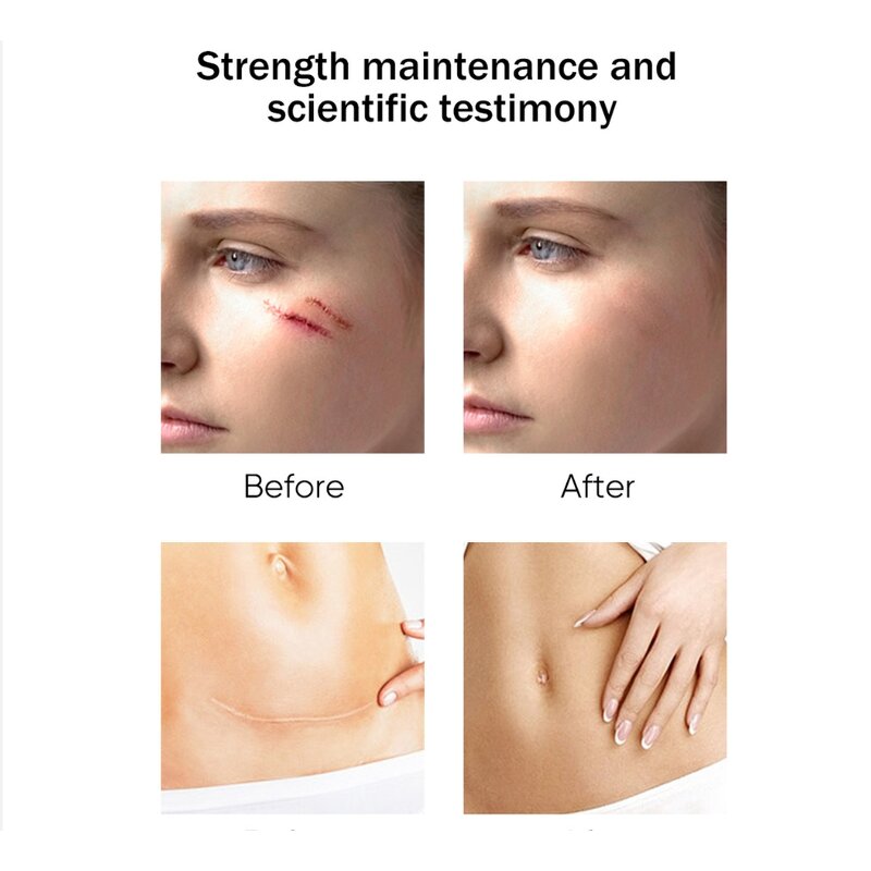 Scar Serum Factory - Facial Body Moisturizing Repair