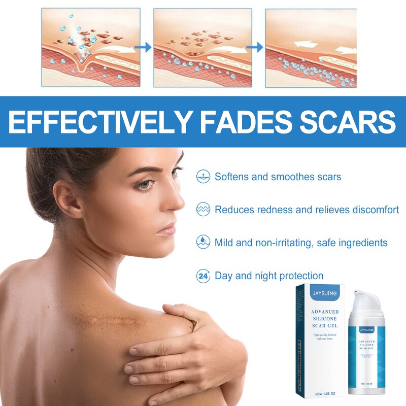 Scar Removal Cream Manufacturer - Wholesale Best-selling Quick