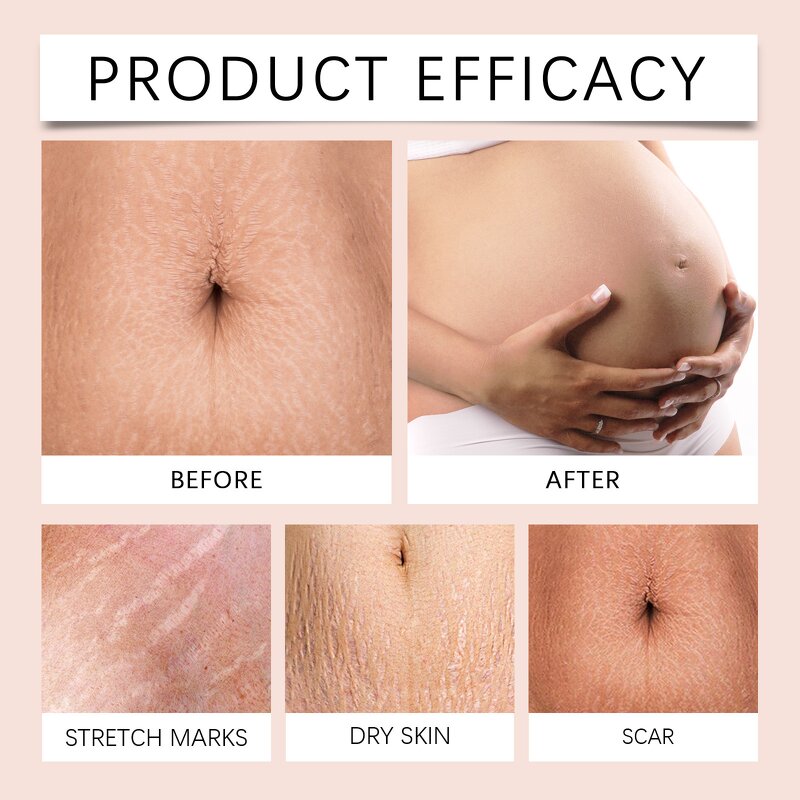 Whitening Cream Manufacturer - Private Moisturizing