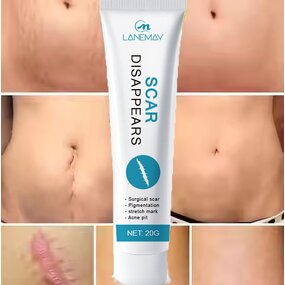 Scar Repair Cream Manufacturer - Best-selling Rapid Healing