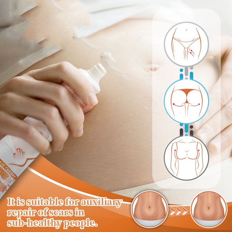 Scar Repair Cream Factory - Hot Sale Lavender Fast Repair