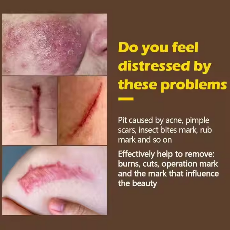 Scar Repair Cream Manufacturer - Best-selling Rapid Healing