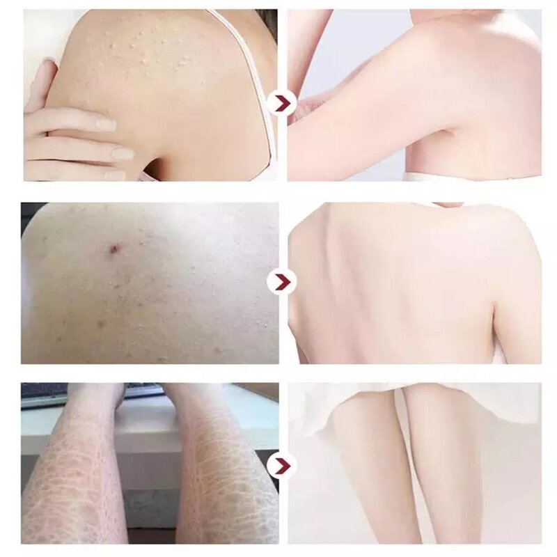 Black Soap Factory - African Moroccan Argan Rose