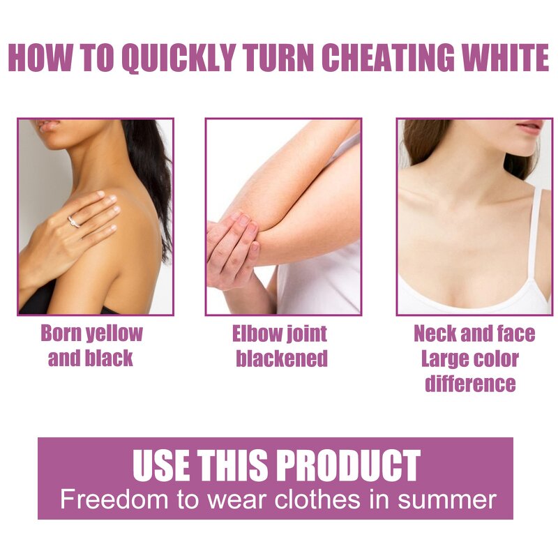 Anti-stretch Mark Cream Manufacturer - Wholesale Best-selling