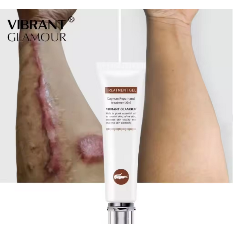 Body Repair Cream Manufacturer - Wholesale Herbal Cold