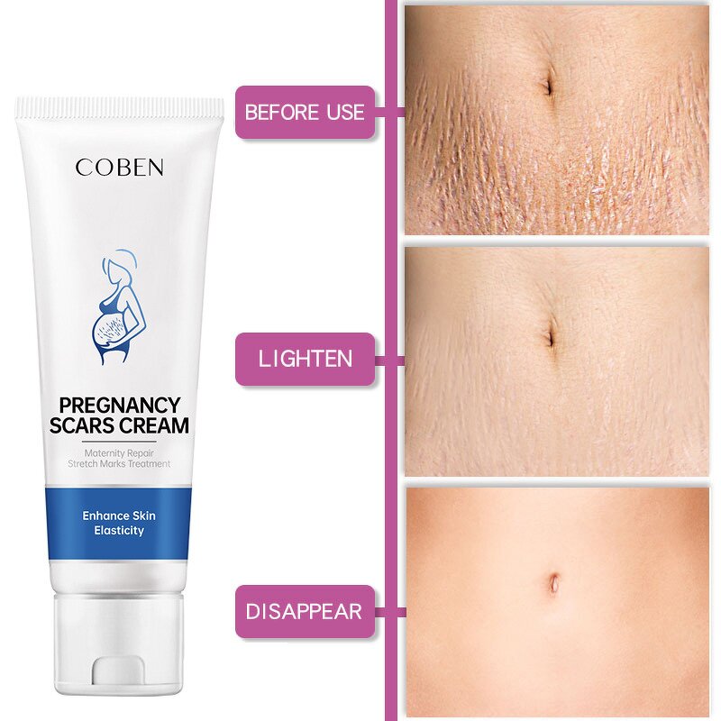 Whitening Cream Manufacturer - Private Moisturizing