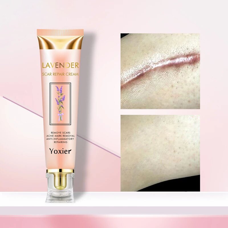 Scar Removal Cream Factory - 50ml Caesarean Section Care