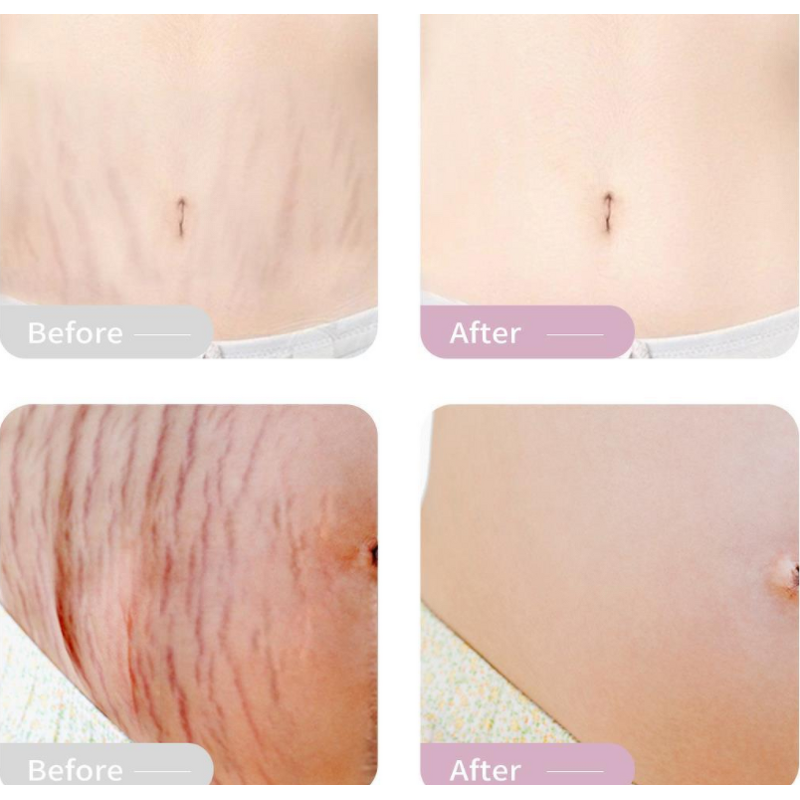 Whitening Cream Manufacturer - Private Moisturizing