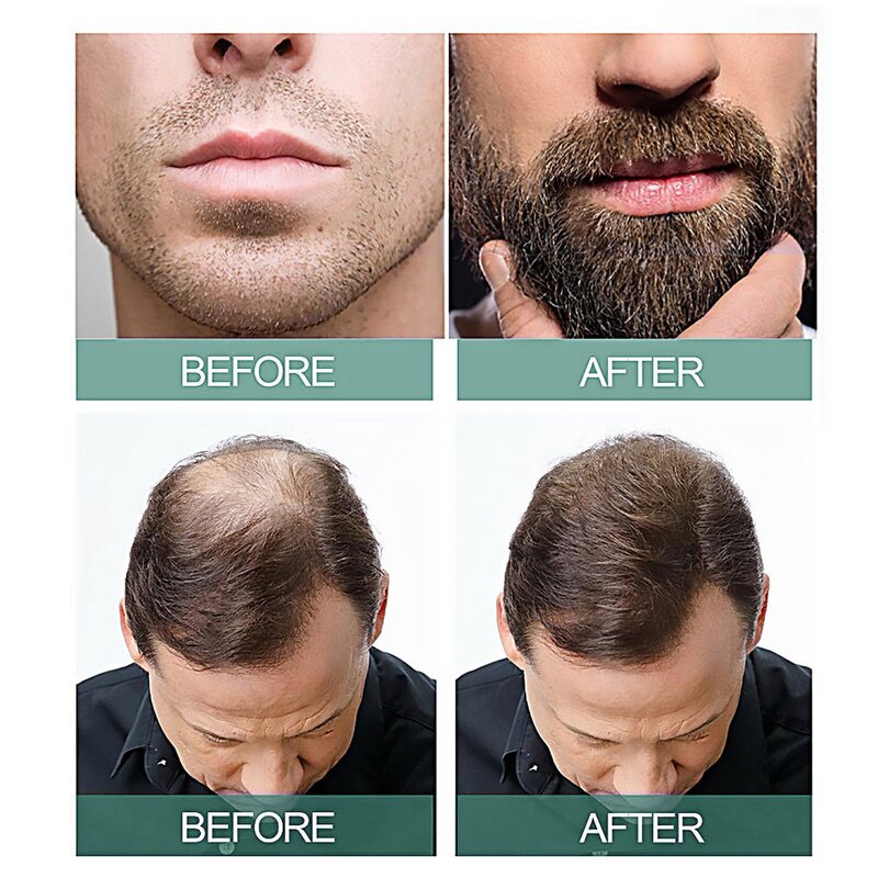 Hair Cream Manufacturer - Herbal Growth Prevention