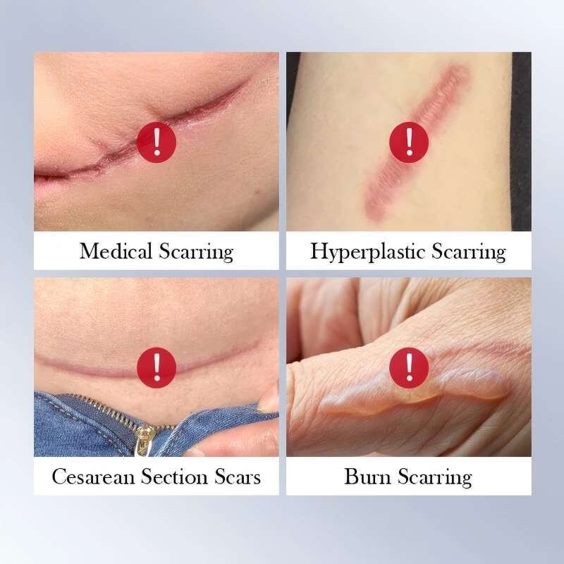 Pregnancy Scar Cream Factory - Women's Lighten Body Skin