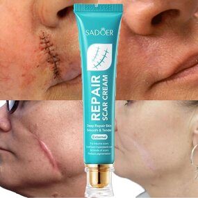 Scar Gel Manufacturer - Lighten Pregnancy Surgery Scar