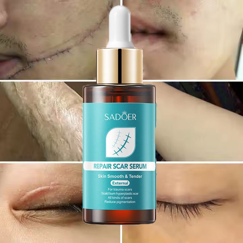 Pregnancy Scar Cream Factory - Women's Lighten Body Skin