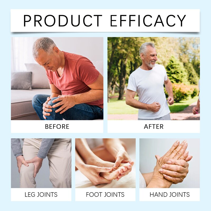 Hyaluronic Acid Joint Cream Supplier - Bulk Wholesale