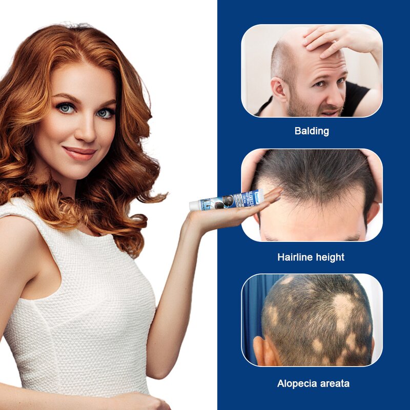 Hair Growth Cream Supplier - Scalp Care Custom Formula