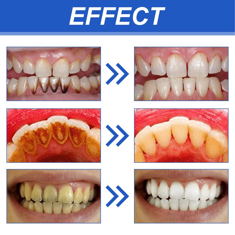 Teeth Whitening Mouthwash Factory - Fresh Breath OEM