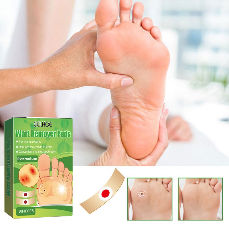 Corn Removal Plaster Factory - Wart Care OEM/ODM