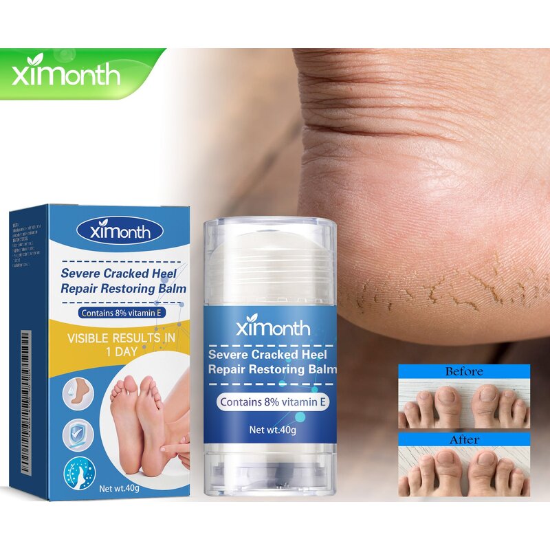 Cracked Heel Balm Factory - Professional Repair OEM