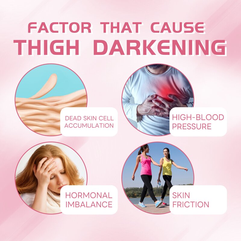 Body Whitening Cream Factory - Repairing Custom Formula