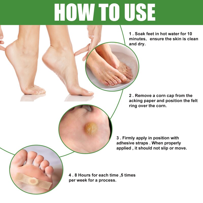 Corn Removal Plaster Factory - Wart Care OEM/ODM