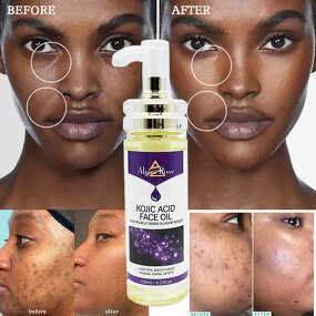 Kojic Acid Oil Factory - Wholesale Korean Cosmetics