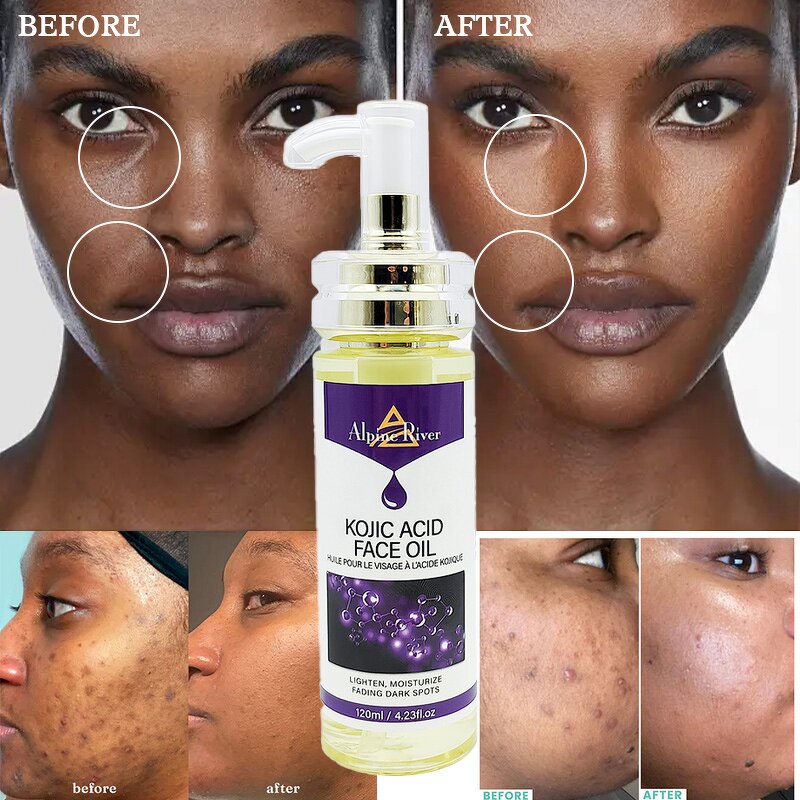 Kojic Acid Oil Factory - Wholesale Korean Cosmetics