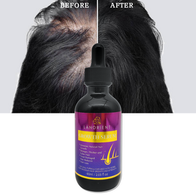 Hair Growth Oil Factory - Private Label Vegan Organic