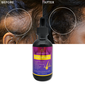 Hair Growth Serum Factory - Private Label LANORIENT