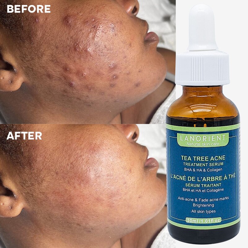 Skin Brightening Serum Manufacturer - Private Label Korean