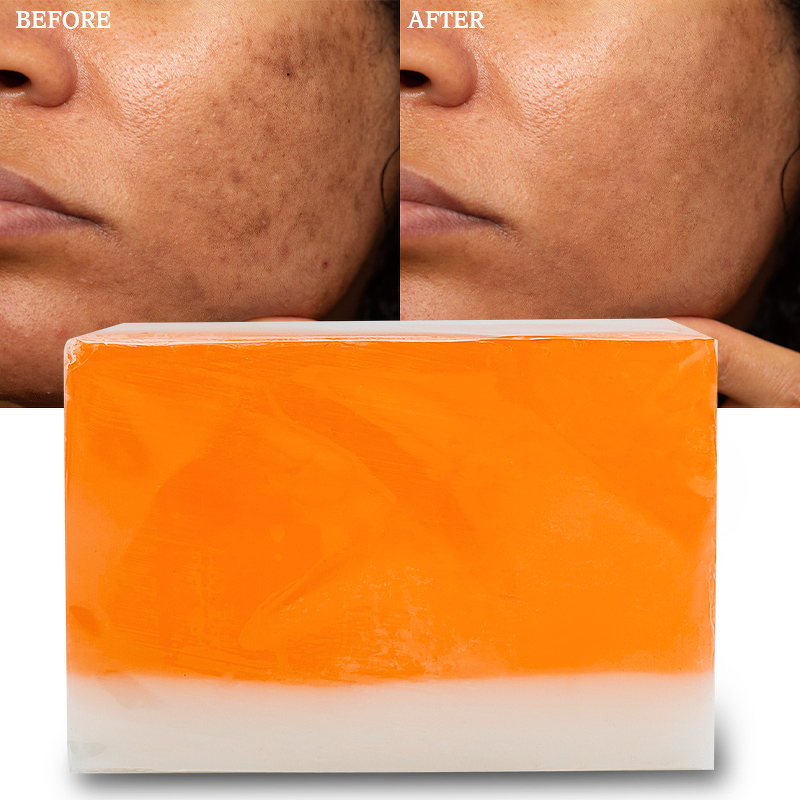 Papaya Honey Soap Manufacturer - Private Label Skin