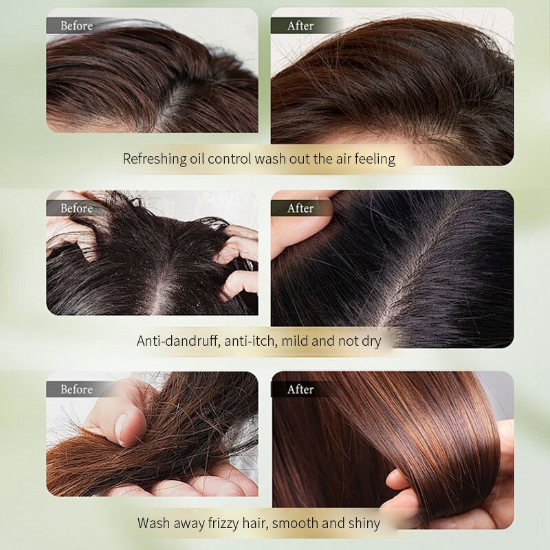 Anti-Dandruff Shampoo Manufacturer - Gu Se Mu 500ml OEM