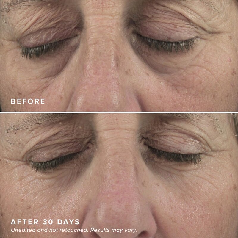 Hydrogel Eye Patch Factory - Factory Wholesale OEM/ODM