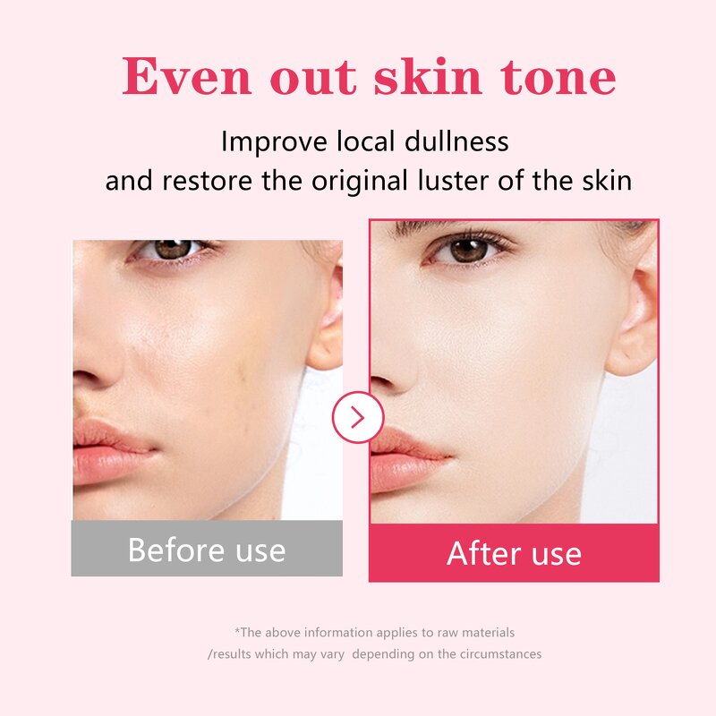 Skin Care Serum Factory - OEM Korean Anti Dark Spot