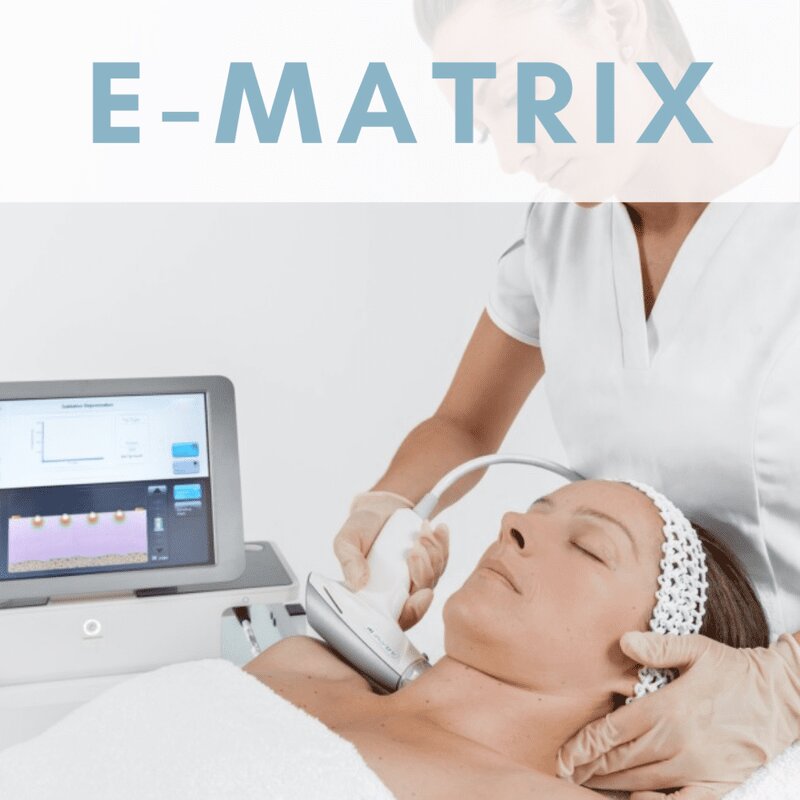 Laser Skin Rejuvenation Machine Supplier - RF Matrix Sublative