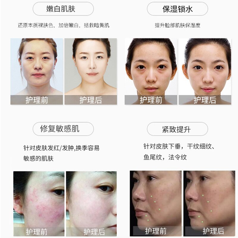 Skin Rejuvenation Machine Manufacturer - Jet Water Light OEM