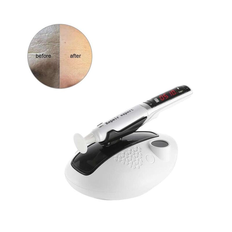 Plasma Pen Manufacturer - Newest Technology Ozone Acne