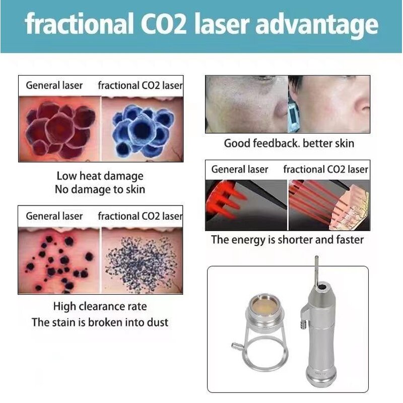CO2 Laser Machine Manufacturer - 45W RF Tube CE Approved