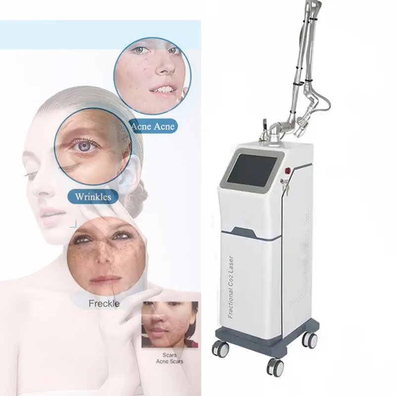 Diode Laser Machine Supplier - 1064nm Skin Tightening Stretch