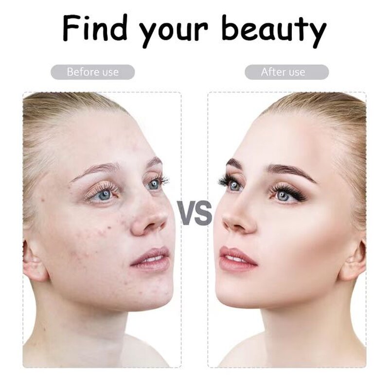 Derma Pen Factory - Nano MTS Wireless Rechargeable