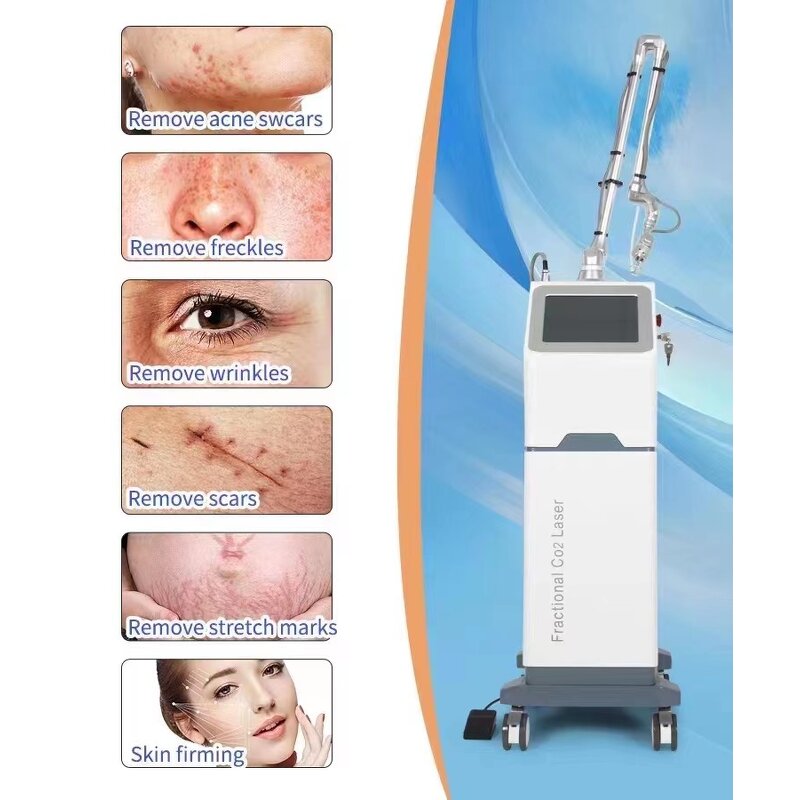 Diode Laser Machine Supplier - 1064nm Skin Tightening Stretch