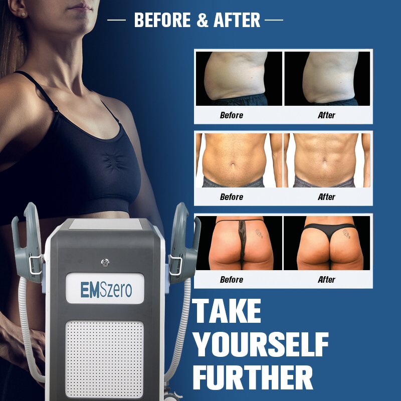 Body Sculpting Machine Factory - Weight Loss Muscle Stimulator